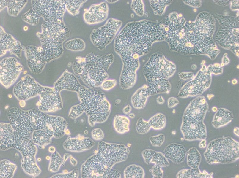 NCI-H1944 Cell Complete Medium - 2
