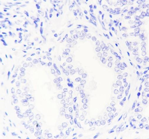 Recombinant HSD17B1 Monoclonal Antibody - small - 3