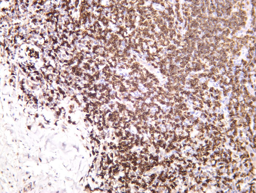 Recombinant CD3e/CD3 epsilon Monoclonal Antibody - 3