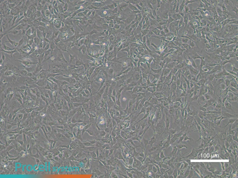Tb 1 Lu Cell Complete MediumTb 1 Lu Cell Complete Medium - 3