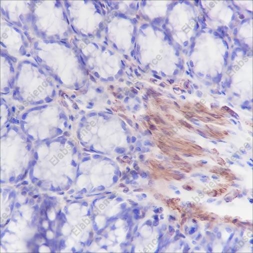 Recombinant Caldesmon/CDM Monoclonal Antibody - 2