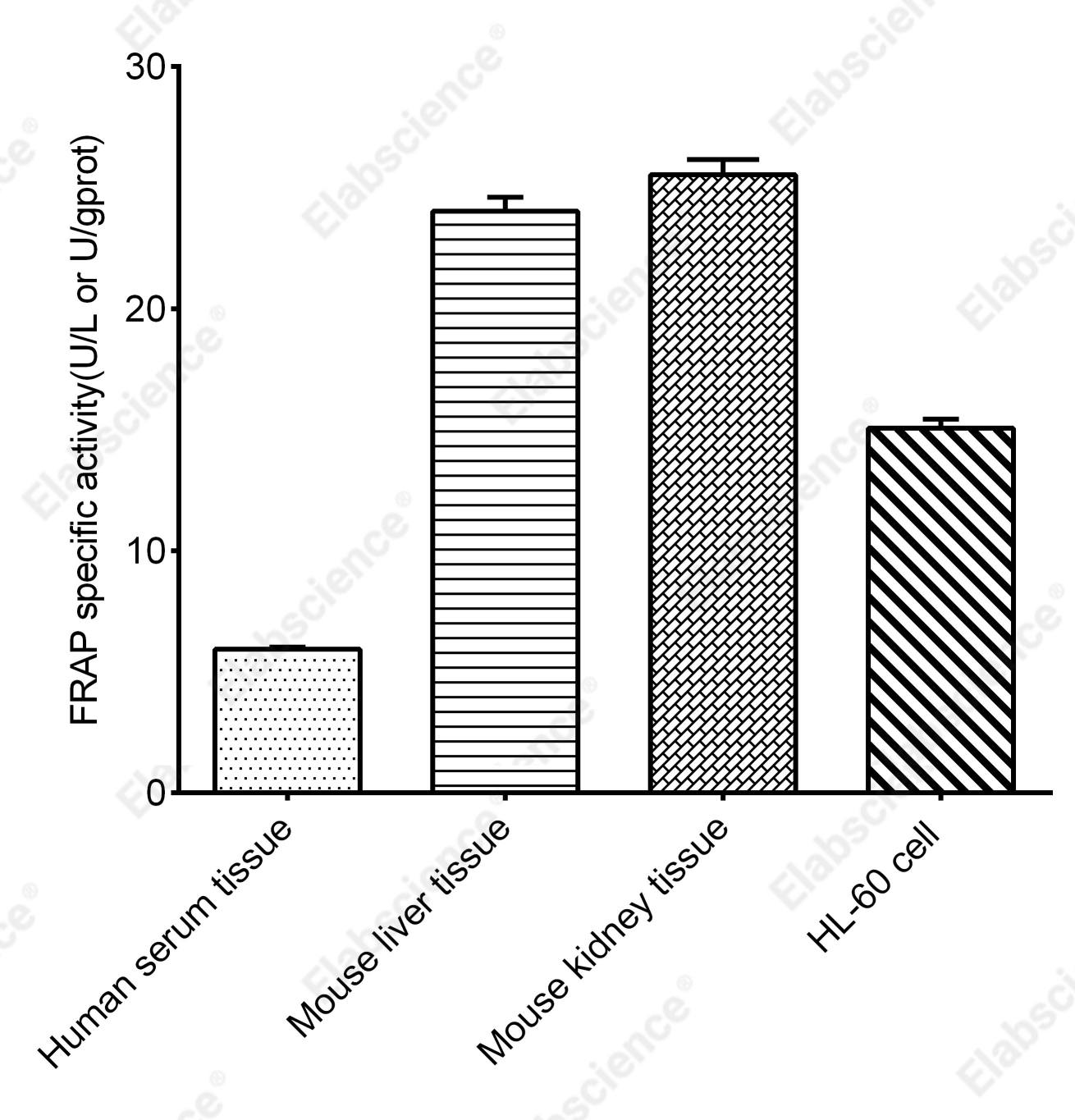 Fluoride Resistant Acid Phosphatase (FRAP)  Activity Assay Kit - 2