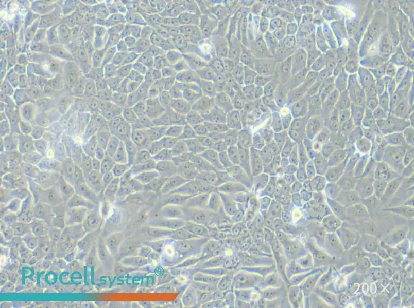 Eca-109 Cell Complete Medium - 5