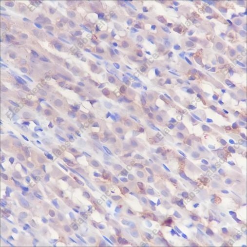 Recombinant GOT2 Monoclonal Antibody - 4