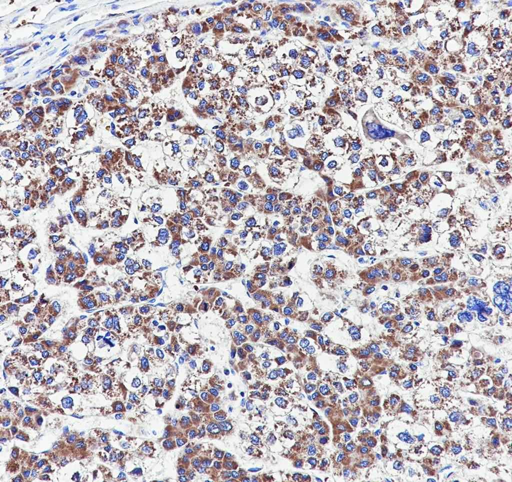 Recombinant SUCLG1 Monoclonal Antibody - small - 5