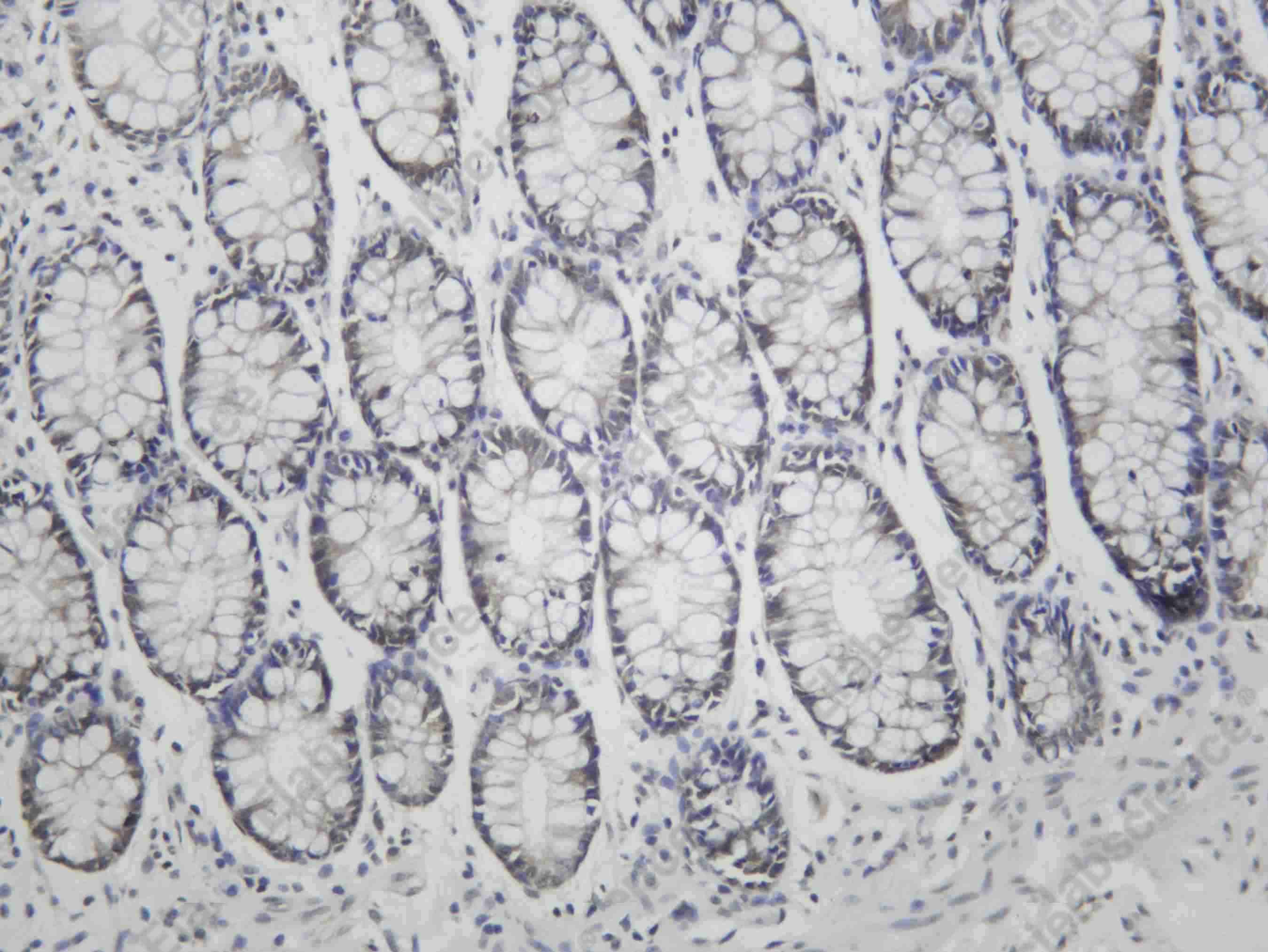 Recombinant Casein Kinase II α Monoclonal Antibody - 1
