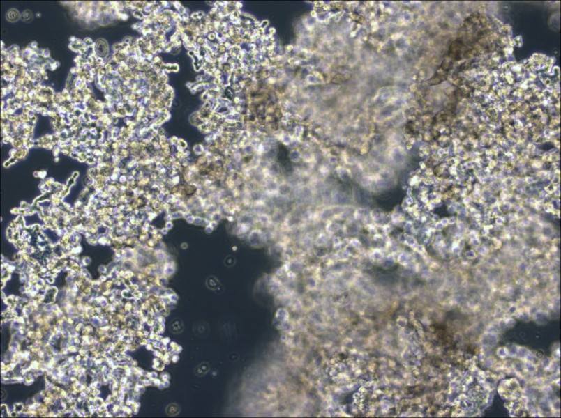 NCI-H526 Cell Complete Medium-searchlist-1