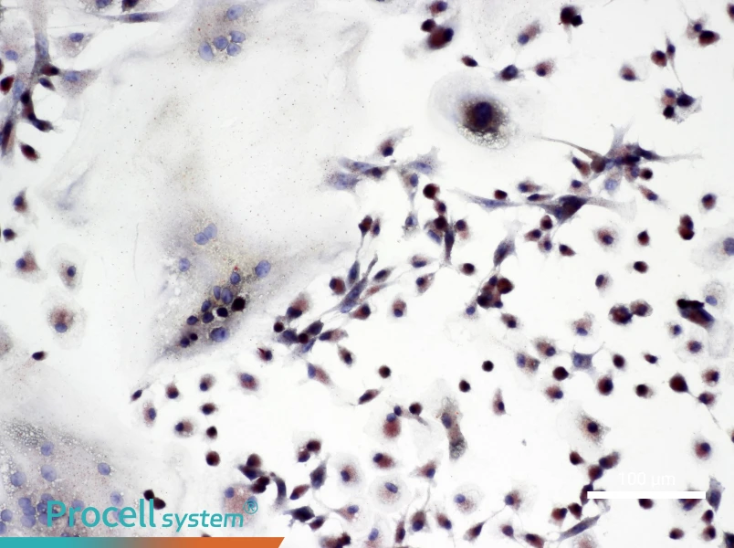 Rat Osteoclast Cell Complete Medium - 1