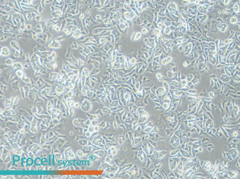 VCaP Cell Complete Medium - 2