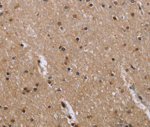 GAB2 Polyclonal Antibody - 3