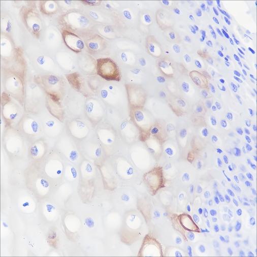 Recombinant Keratin 4 Monoclonal Antibody - small - 2