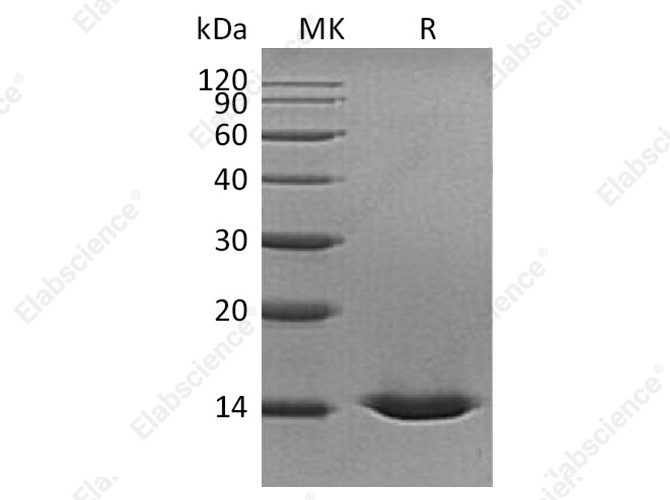 Recombinant Human Cystatin D Protein (His Tag) - 1
