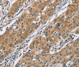 COPB1 Polyclonal Antibody - 3