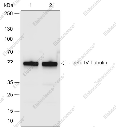 Recombinant beta IV Tubulin Monoclonal Antibody - 1