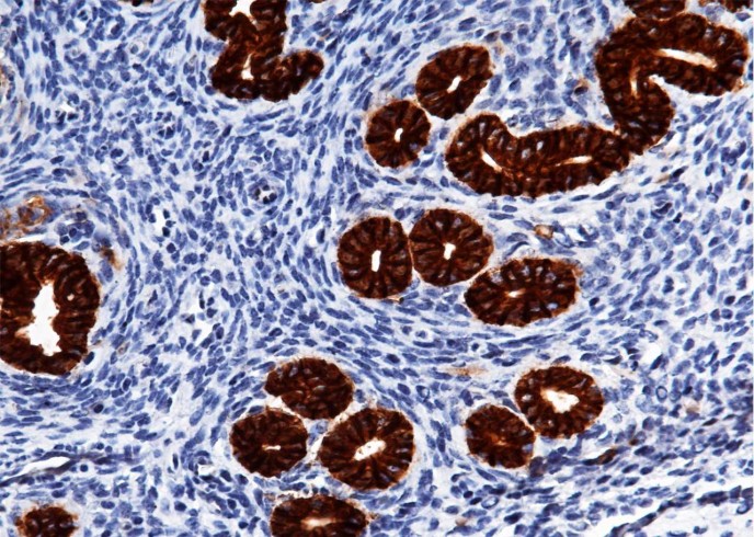 Recombinant EpCAM/TROP-1/TACSTD1 Monoclonal Antibody-searchlist-1