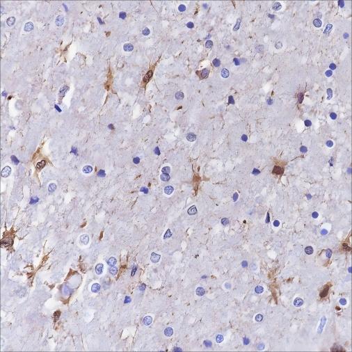 Recombinant S100A13 Monoclonal Antibody-searchlist-1