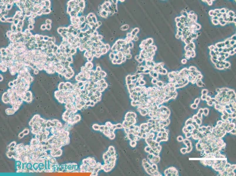 HCC1187 - 6