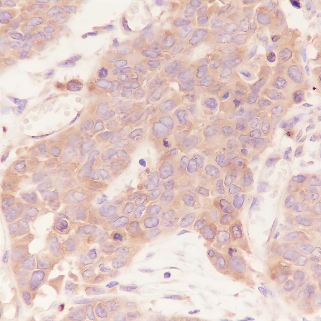 Recombinant LPCAT1 Monoclonal Antibody - 2