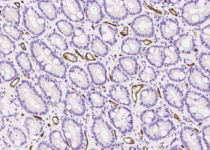CD34 Monoclonal Antibody - small - 2