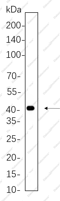 Recombinant MEK4 Monoclonal Antibody - 1