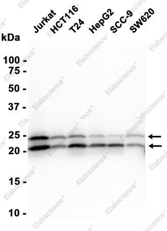 Recombinant Proteasome 20S LMP2 Monoclonal Antibody - 3