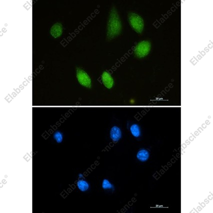 Recombinant Choline Acetyltransferase Monoclonal Antibody - 2
