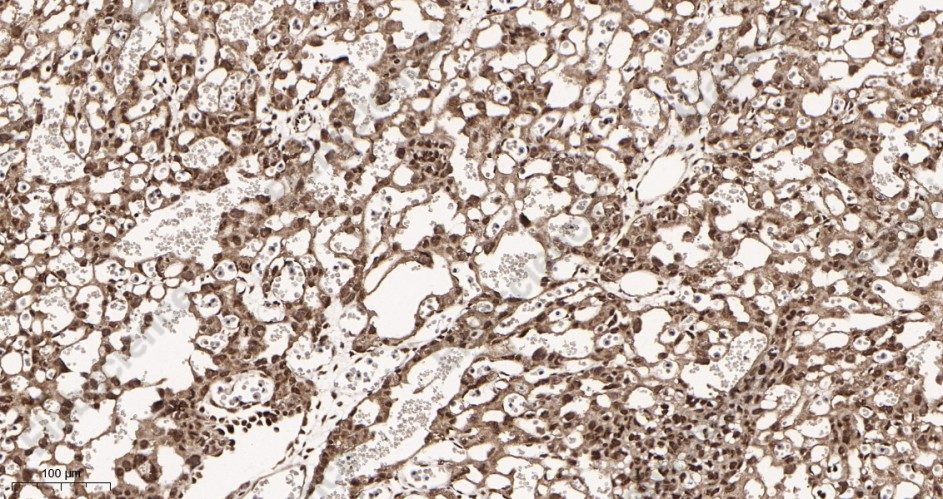Recombinant MiTF Monoclonal Antibody - 3