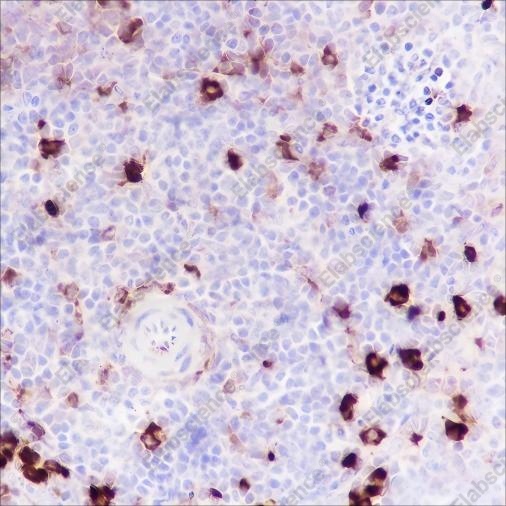 Recombinant Phospho-S6 Ribosomal Protein (Ser240, 244) Monoclonal Antibody - 6