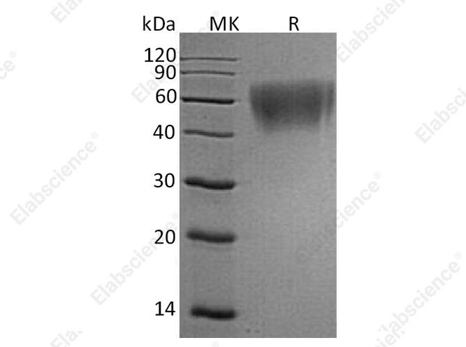 Recombinant Human ICOS Ligand/ICOSL Protein (His Tag) - 1