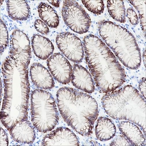 Recombinant PI3 Kinase p110 alpha Monoclonal Antibody - 4
