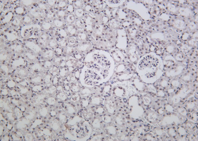 Recombinant BRD4 Monoclonal Antibody-searchlist-1