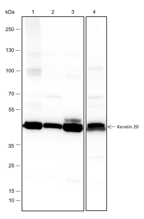 Recombinant Keratin 20 Monoclonal Antibody-searchlist-1