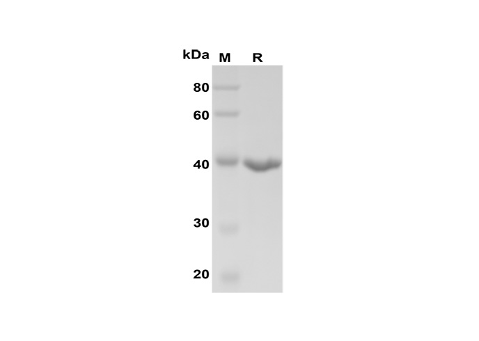 Recombinant Mouse IFN-γ Protein(GST Tag)-产品推荐-1
