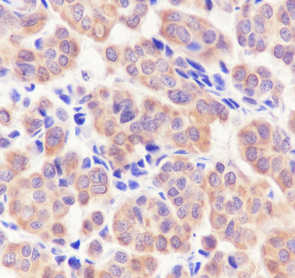 Recombinant SHIP-2 Monoclonal Antibody - small - 3