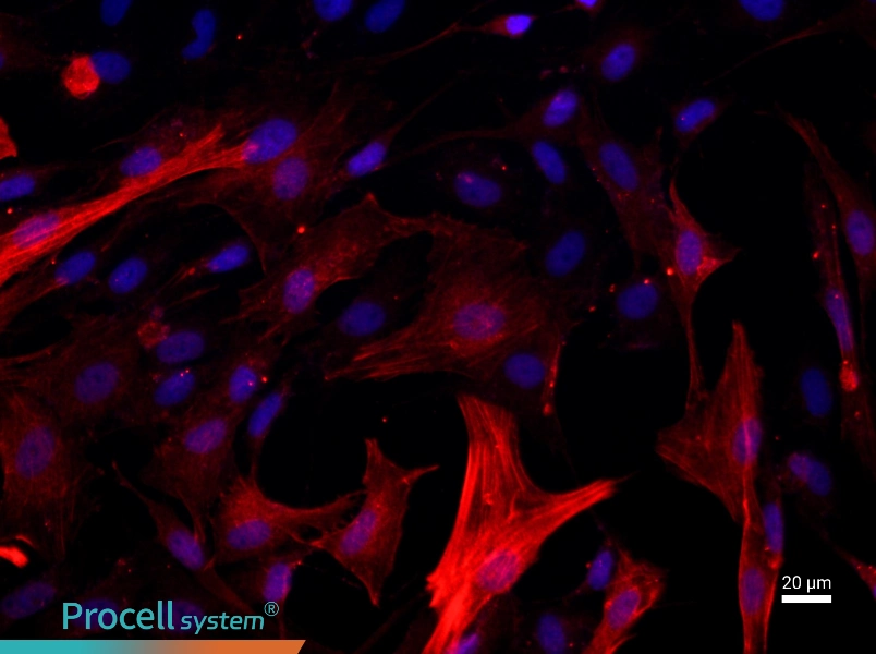 Rat Tracheal Smooth Muscle Cells - 1