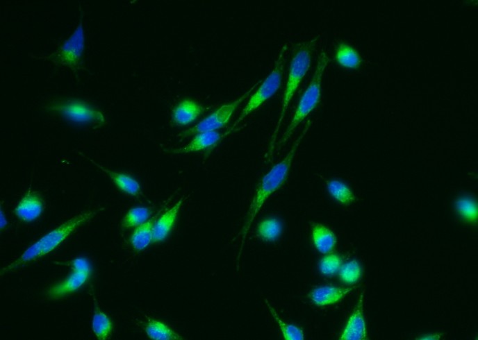 Recombinant Nicastrin/NCSTN Monoclonal Antibody-searchlist-1