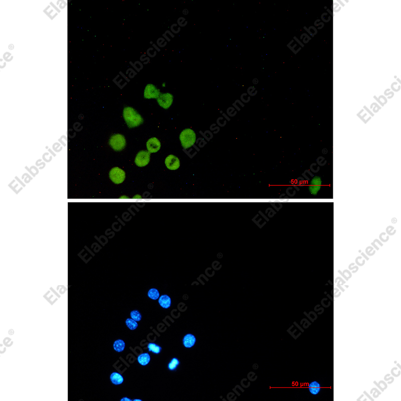 Recombinant SPI1 Monoclonal Antibody - 2
