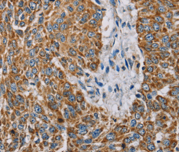 MTFP1 Polyclonal Antibody - 3