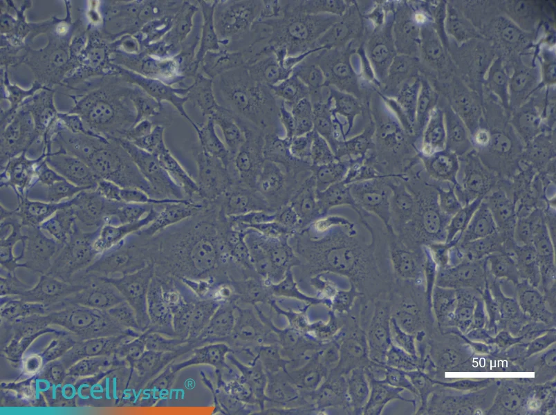 Human Type II Alveolar Epithelial (Primary cell immortalization) Cell Complete Medium - 4