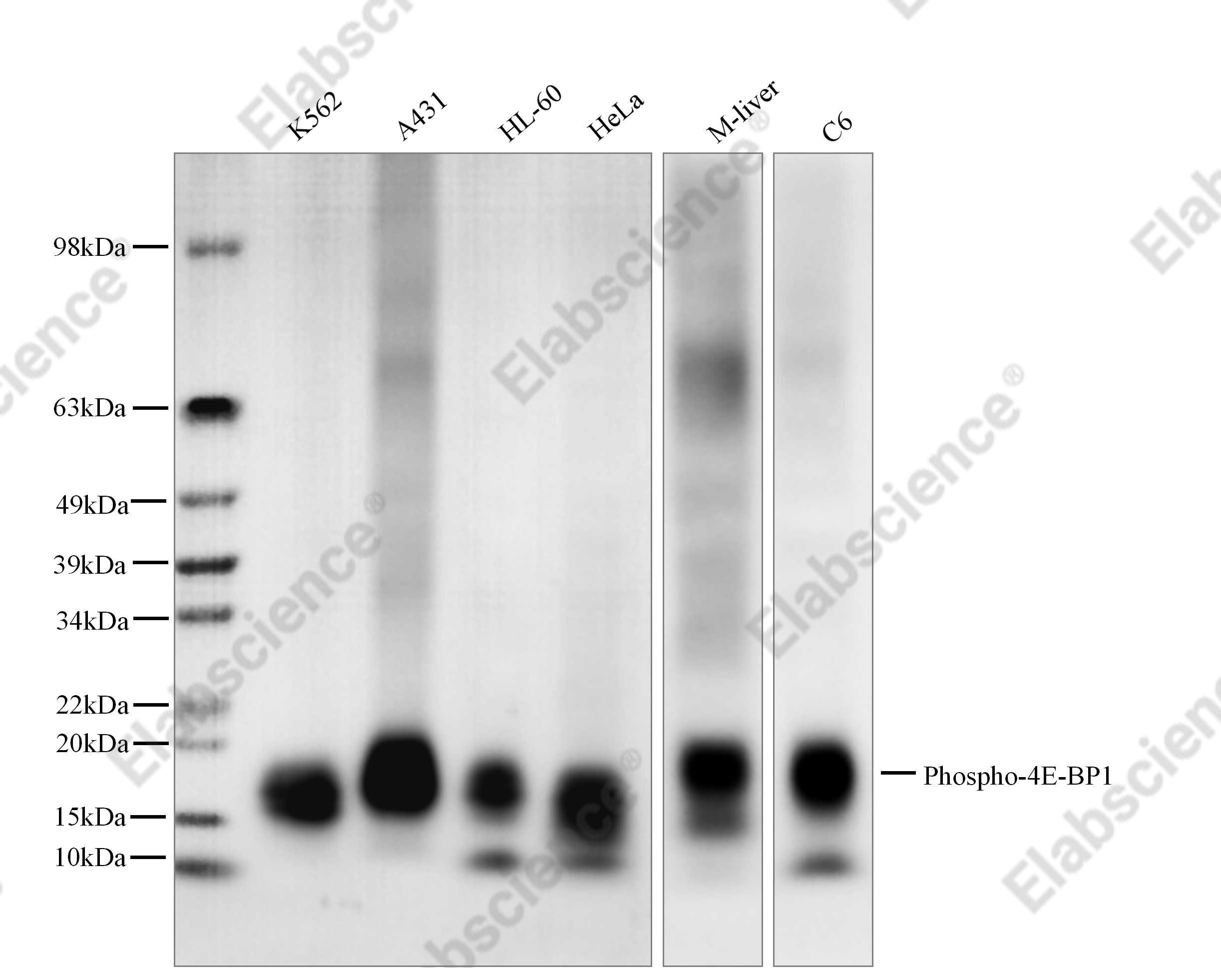 Recombinant Phospho-4E-BP1 (Thr37, 46) Monoclonal Antibody - 1