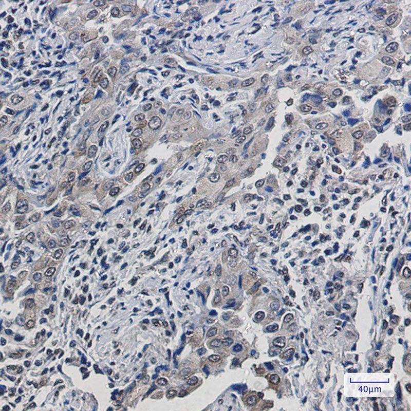 Recombinant SCD1 Monoclonal Antibody - 3
