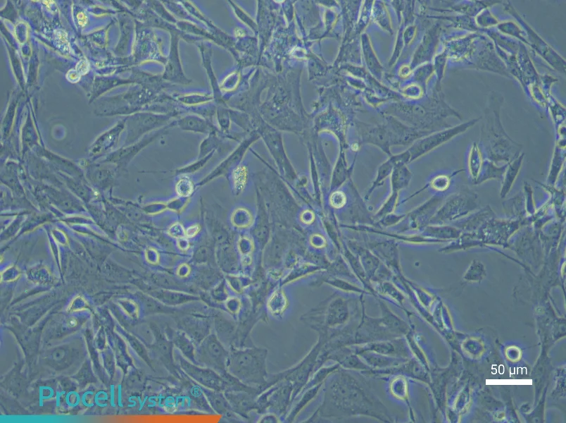 Rat Tracheal Fibroblast Complete MediumRat Tracheal Fibroblast Complete Medium - 5