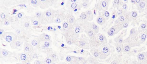 Recombinant Caveolin-3 Monoclonal Antibody - 3