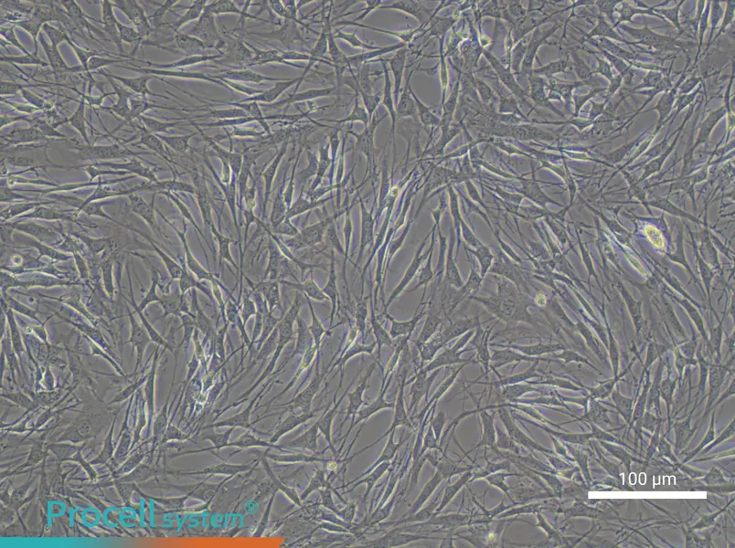OP9 Cell Complete Medium - 1