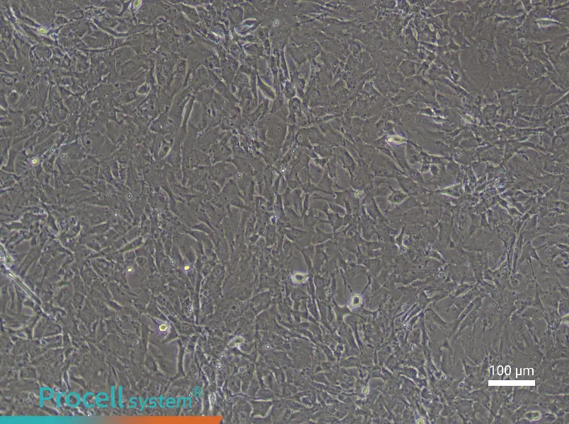 Rat Pulmonary Artery Fibroblast Complete Medium - 3