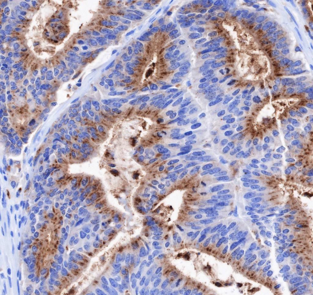 Recombinant CEACAM6 Monoclonal Antibody - small - 3