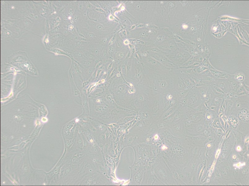 MKN-7 [MKN7; MKN 7] Cell Complete Medium - 2