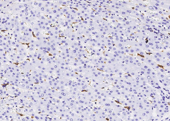 Recombinant CD68 Monoclonal Antibody