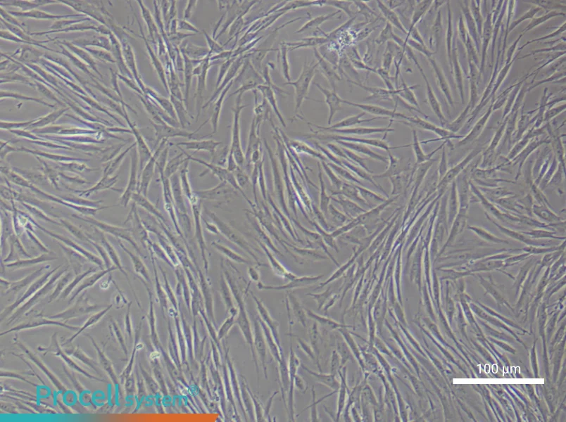 Human Skeletal Muscle Fibroblast Complete Medium - 2