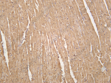 Recombinant PDE3A Monoclonal Antibody - 2